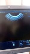 GE RIC5-9-D probe Ultrasound Transducer