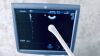 GE Voluson E6 BT 13.5 (BT14) Ultrasound - OB / GYN