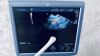 GE Voluson E6 BT 13.5 (BT14) Ultrasound - OB / GYN