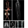 ANKE ANATOM 64 Clarity CT Scanner
