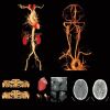 ANKE ANATOM 128 Precision CT Scanner