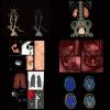 ANKE ANATOM 128 Precision CT Scanner