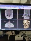 PLANMED VERITY Dental CT