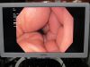 OLYMPUS GIF-HQ190 Gastroscope