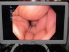 OLYMPUS GIF-HQ190 Gastroscope