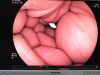 FUJINON EG-450D5 Gastroscope