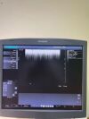 ACUSON/SIEMENS VF13-5 Ultrasound Transducer