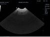 MINDRAY 6C2 Ultrasound Transducer