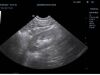 MINDRAY 6C2 Ultrasound Transducer