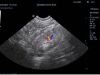 MINDRAY 6C2 Ultrasound Transducer