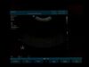 PHILIPS C5-2 Ultrasound Transducer