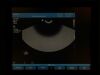 PHILIPS C8-4V Ultrasound Transducer