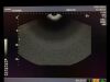 TOSHIBA PVM-651VT Ultrasound Transducer