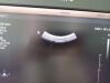 PHILIPS C9-2 Ultrasound Transducer