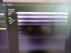 PHILIPS L15-7i0 Ultrasound Transducer