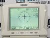 MARCO LM1000 Lensometer