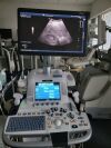 GE Logiq E9 XDclear Ultrasound - Shared Service