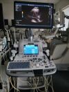 GE Logiq E9 XDclear Ultrasound - Shared Service