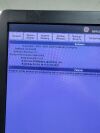 GE Logiq E9 XDclear Ultrasound - Shared Service