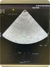 ACUSON/SIEMENS 4V1c Cardiac Ultrasound Transducer
