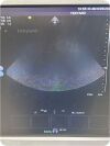 ACUSON/SIEMENS 4V1c Cardiac Ultrasound Transducer