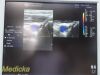 GE HEALTHCARE GE i12L Linear Array Ultrasound Transducer