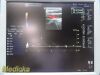 GE HEALTHCARE GE i12L Linear Array Ultrasound Transducer