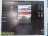 GE HEALTHCARE GE i12L Linear Array Ultrasound Transducer