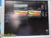 GE M12L Matrix Array Linear Ultrasound Transducer