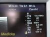 GE M12L Matrix Array Linear Ultrasound Transducer
