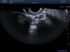 TOSHIBA PVT-781VT Ultrasound Transducer