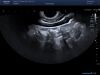 TOSHIBA PVT-781VT Ultrasound Transducer