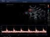 TOSHIBA PVT-781VT Ultrasound Transducer