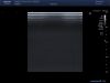 TOSHIBA PLT704SBT Ultrasound Transducer