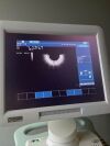  Biosound esaote MyLab20Plus XVISION Machine SN: 05494 w/ Probes: EC1123 , CA631 Ultrasound - Shared Service