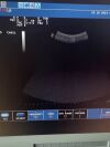  Biosound esaote MyLab20Plus XVISION Machine SN: 05494 w/ Probes: EC1123 , CA631 Ultrasound - Shared Service