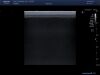 TOSHIBA PLT-705BT Ultrasound Transducer