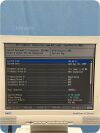 JAEGER Masterscreen PFT Analyzer PFT Unit