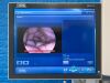 KARL STORZ Image 1 Hub With H3-Z Camera Head Complete Full HD Tower Laparoscope