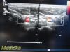 PHILIPS L17-5, Frequency 5.0 – 17.0MHz~  Linear Array Ultrasound Transducer
