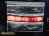 PHILIPS L17-5, Frequency 5.0 – 17.0MHz~  Linear Array Ultrasound Transducer