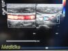 PHILIPS L17-5, Frequency 5.0 – 17.0MHz~  Linear Array Ultrasound Transducer