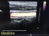 PHILIPS L9-3 Linear Array Ultrasound Transducer
