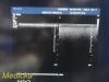 PHILIPS L9-3 Linear Array Ultrasound Transducer