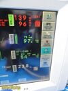 SPACELABS 91369 Ultraview ,W/ 91496 Module, PSU,Leads;Nellcor~ Touch Monitor