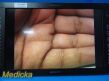 SONY Olympus  LMD-2451MT 24&quot; 2D/3D LCD Display Monitor