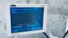 KARL STORZ ENDOSCOPY Image 1 Hub System Endoscopy set