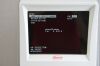 KOWA nonmyd 8s Retinal Fundus Camera - 172098 Fundus Camera
