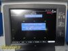 MD Engineering LS-1000 Power Aspirator   Aspirator Liposuction Pump W/ Foot Control