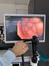 OLYMPUS CF-H180AI Colonoscope